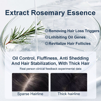 Tgideas Caviar & Rosemary Shampoo: Volumizing & Oil Control Formula